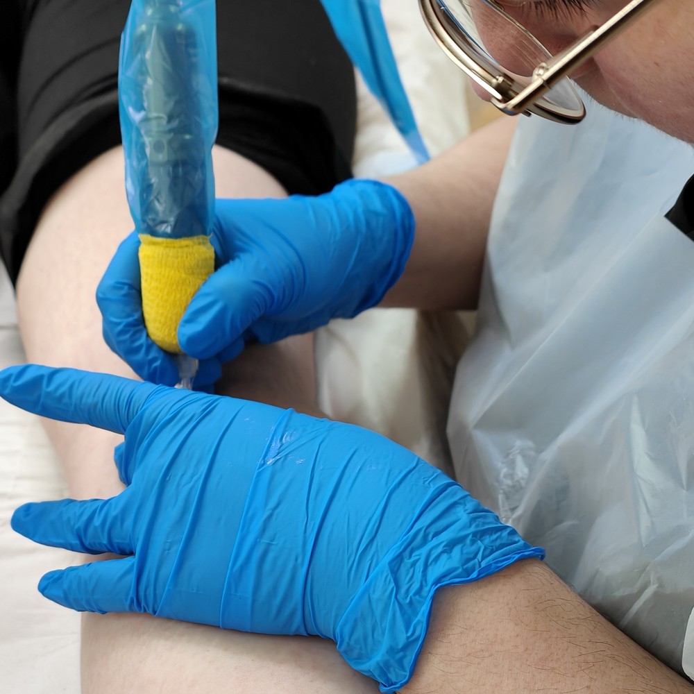 Medical needling treatment on leg, professional equipment